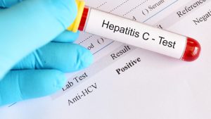 Hepatit C Testi