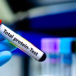 Total Protein Testi