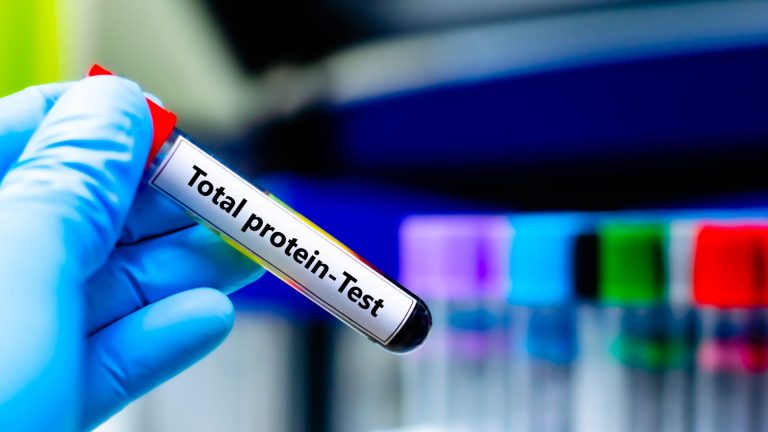 Total Protein Testi