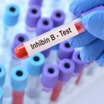 İnhibin B Testi