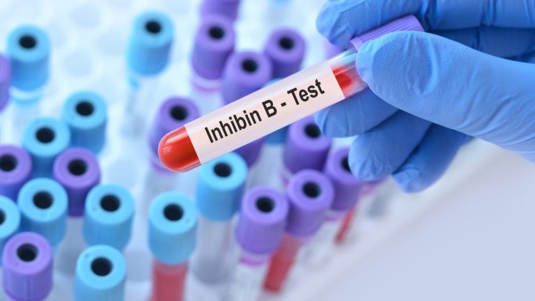 İnhibin B Testi