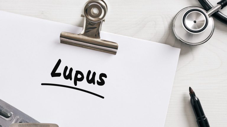 Lupus Antikoagülanı Testi