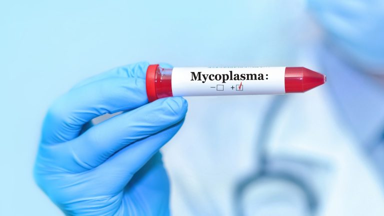 Mycoplasma Genitalium Testi
