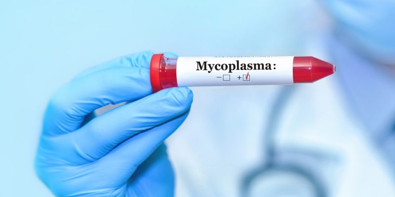 Mycoplasma Genitalium Testi