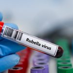 Rubella IgG Avidite Testi