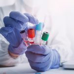 Kızamık Rubeola IgG Testi