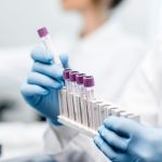 Kızamık Rubeola IgM Testi