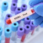 SHBG Testi