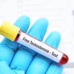 Serbest Testosteron Testi