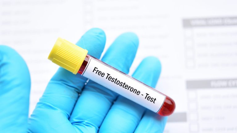 Serbest Testosteron Testi