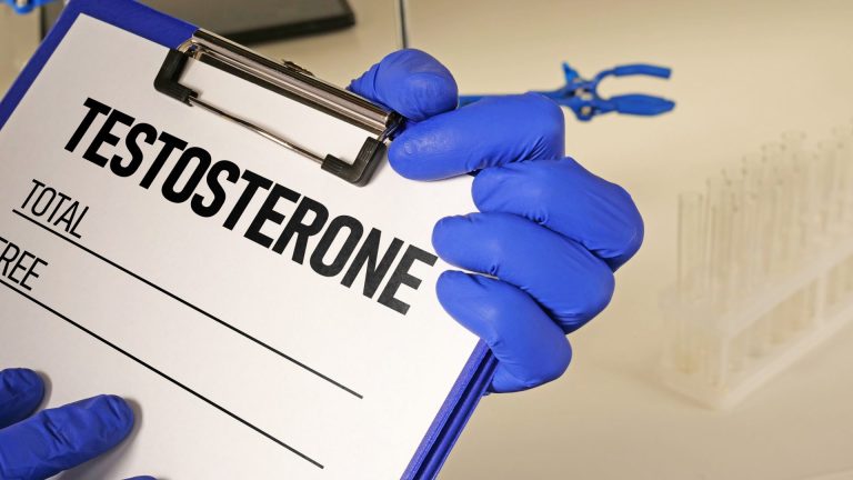 Total Testosteron Testi