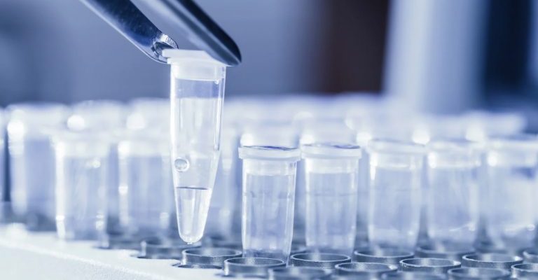 Ureaplasma Testi