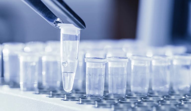 Ureaplasma Testi