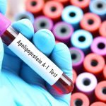 Apolipoprotein A1 Testi