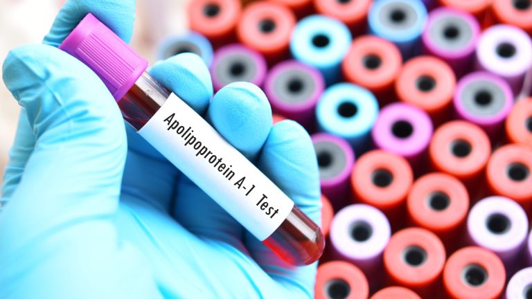 Apolipoprotein A1 Testi