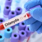 Chlamydia Trachomatis DNA PCR Testi