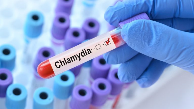 Chlamydia Trachomatis DNA PCR Testi