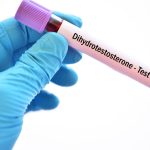 Dihidrotestosteron Testi