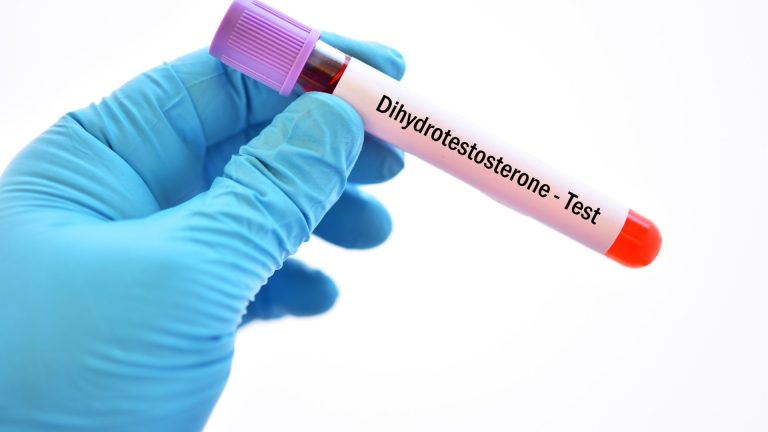 Dihidrotestosteron Testi