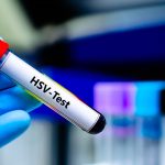 HSV DNA PCR Testi