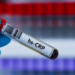 hs-CRP Testi