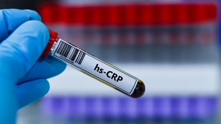 hs-CRP Testi