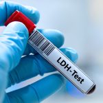 LDH Testi
