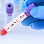Troponin T Testi
