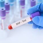 BNP Testi