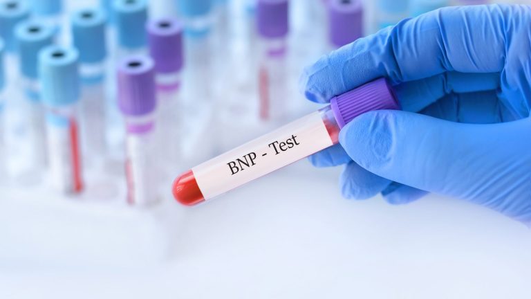 BNP Testi