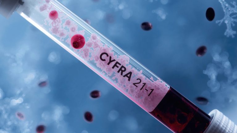 Cyfra 21-1 Testi
