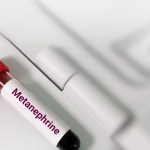 Metanefrin Testi