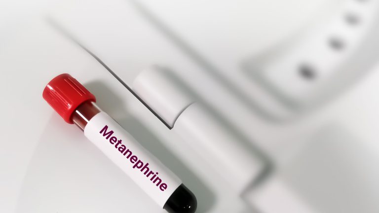 Metanefrin Testi