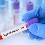 Mycoplasma Genitalium DNA PCR Testi