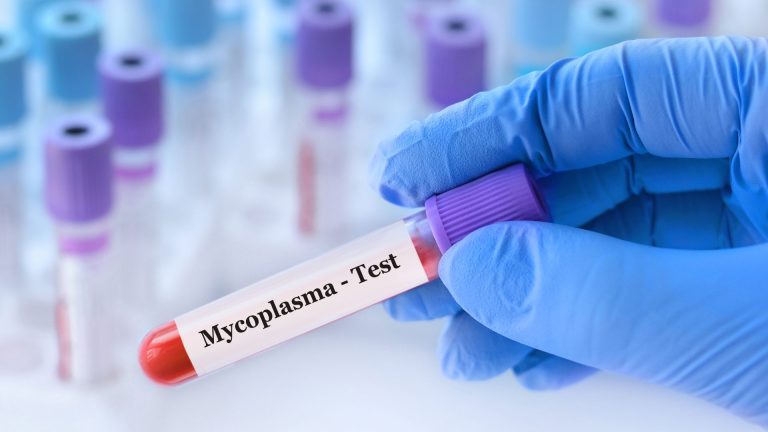 Mycoplasma Genitalium DNA PCR Testi