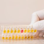 Mycoplasma Hominis DNA PCR Testi