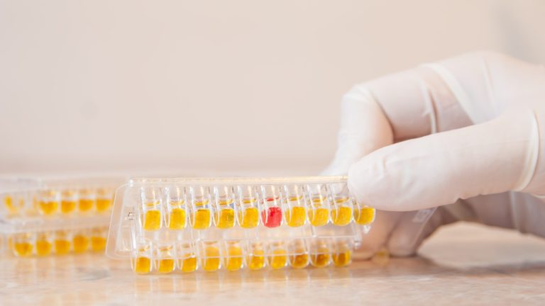 Mycoplasma Hominis DNA PCR Testi