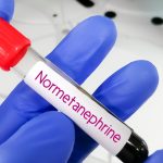 Normetanefrin Testi
