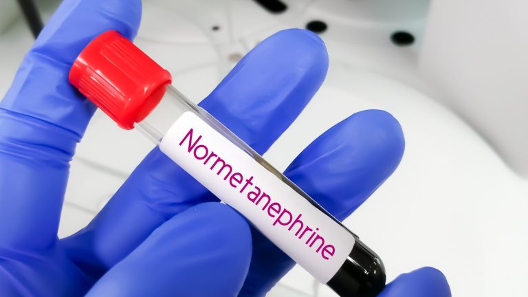 Normetanefrin Testi