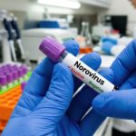 Norovirüs Antijeni Testi