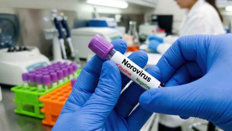 Norovirüs Antijeni Testi