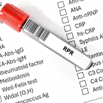 RPR Testi