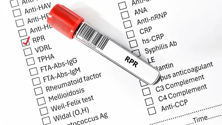 RPR Testi