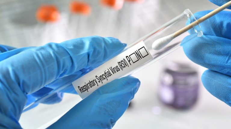 RSV Antijeni Testi