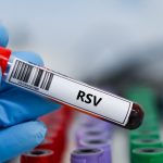 RSV RNA PCR Testi