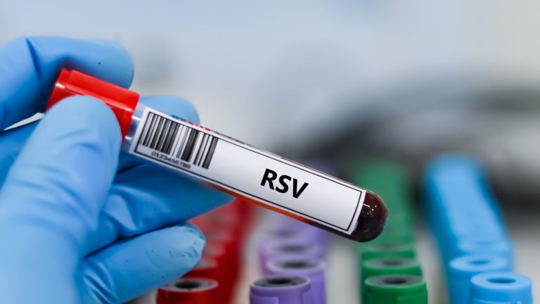 RSV RNA PCR Testi