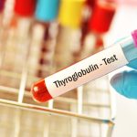 Tiroglobulin Testi