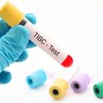 Total Demir Bağlama Kapasitesi Testi