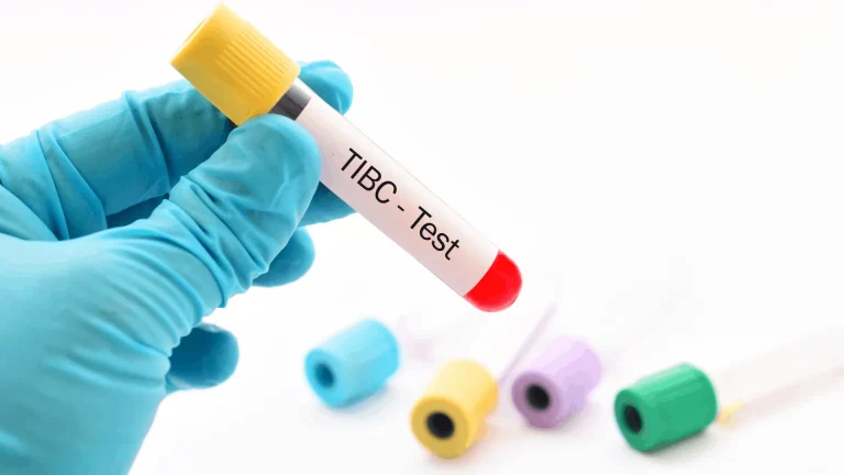 Total Demir Bağlama Kapasitesi Testi