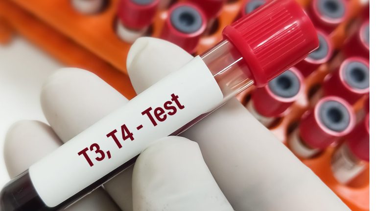 Total T3 Testi